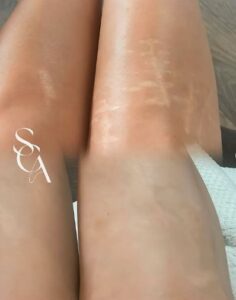 skin camouflage