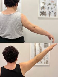 Melior Physiotherapy
