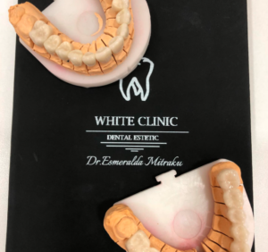 authentic dental clinic durres
