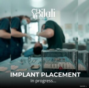 Bilali Dent